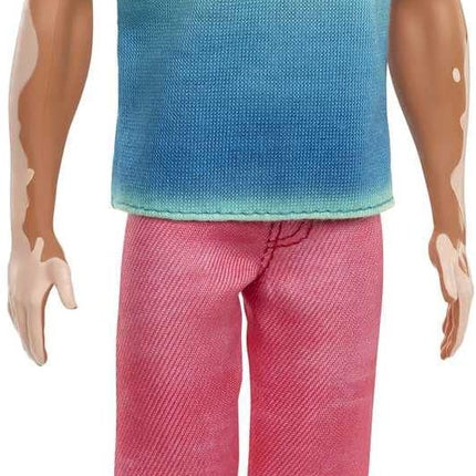 Barbie Fashionistas Ken Fashion Doll #192 with Brunette Cropped Hair & Vitiligo in Malibu Tank, Shorts & Sandals