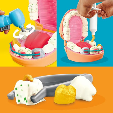 Play-Doh Drill 'n Fill Dentist Toy for Kids 3 Years and Up with Cavity and Metallic Colored Modeling Compound, 10 Tools, 6 Total Cans, 2 Ounces Each, Non-Toxic, Assorted Colors